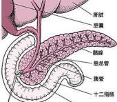 环形胰腺
